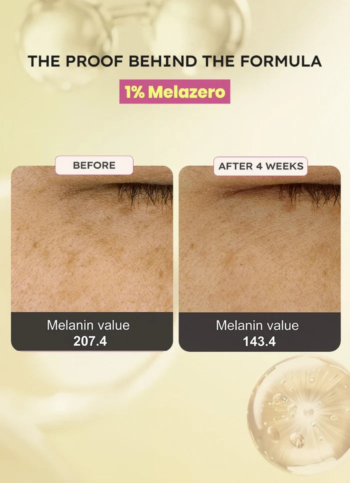Brightening Moisturizer - 50gm